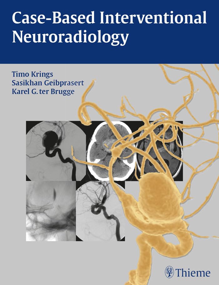 Case-Based Interventional Neuroradiology: 1st Edition, Kindle Edition