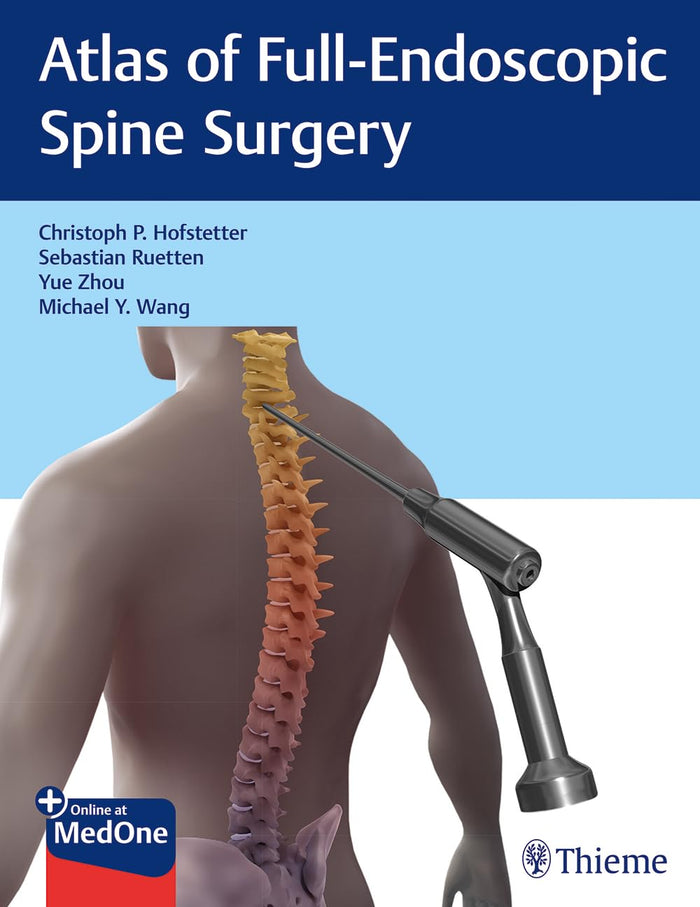 Atlas of Full-Endoscopic Spine Surgery: 1st Edition