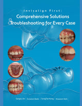 Invisalign First Comprehensive solutions and Trouble shooting for every case: A Step-by-Step Guide to Mixed-Dentition Clear Aligners, Digital Planning and Clinical Troubleshooting Invisalign first
