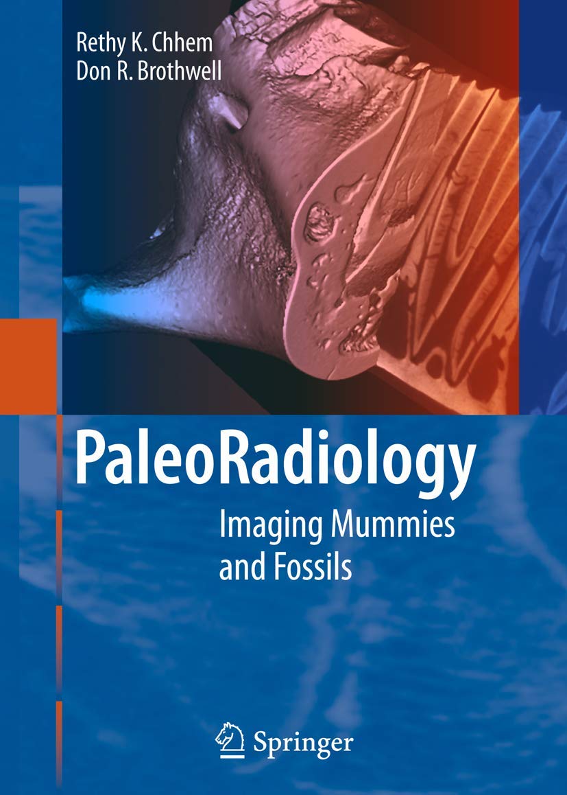 Paleoradiology: Imaging Mummies and Fossils: Softcover reprint of 1st ed. 2008 Edition