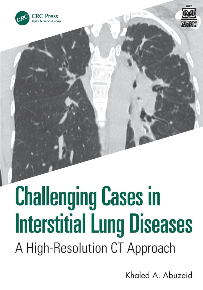Challenging Cases in Interstitial Lung Diseases: 1st Edition