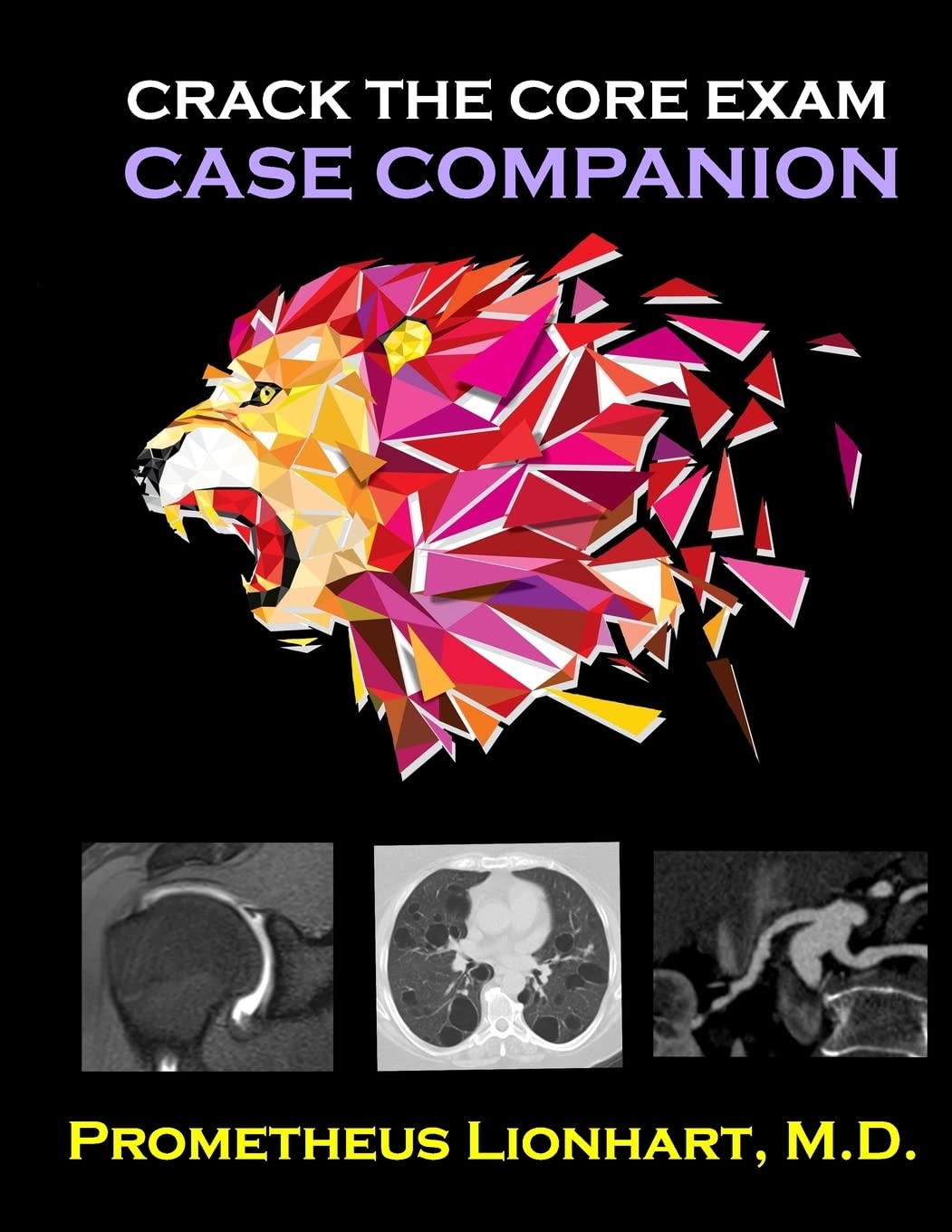 Crack the CORE Exam - Case Companion: 1st Edition