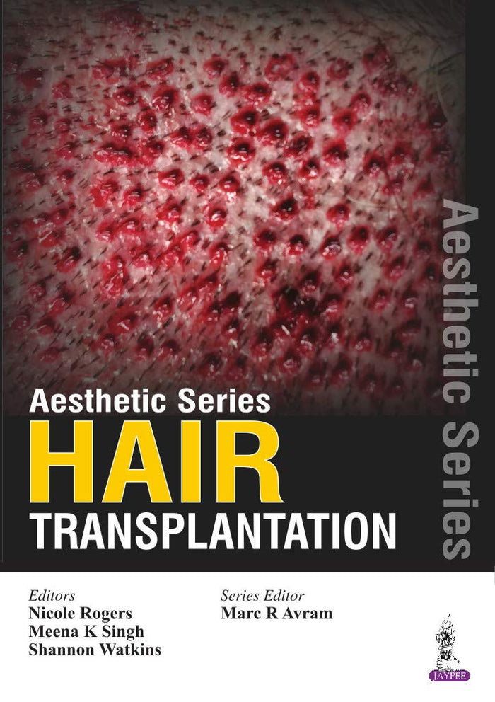 Aesthetic Series—Hair Transplantation: 1st Edition