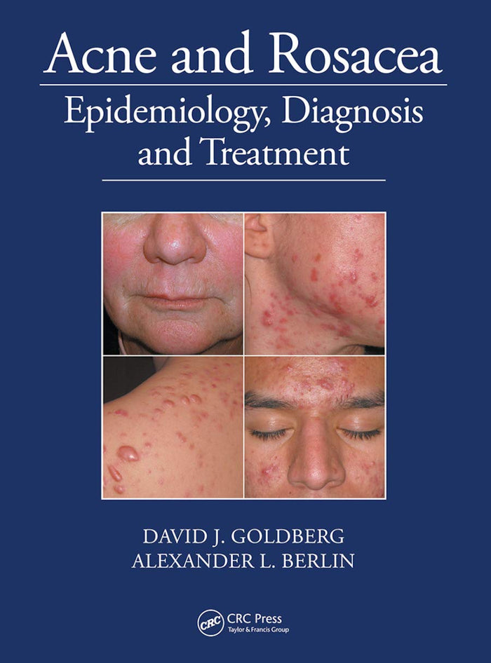 Acne and Rosacea: 1st Edition