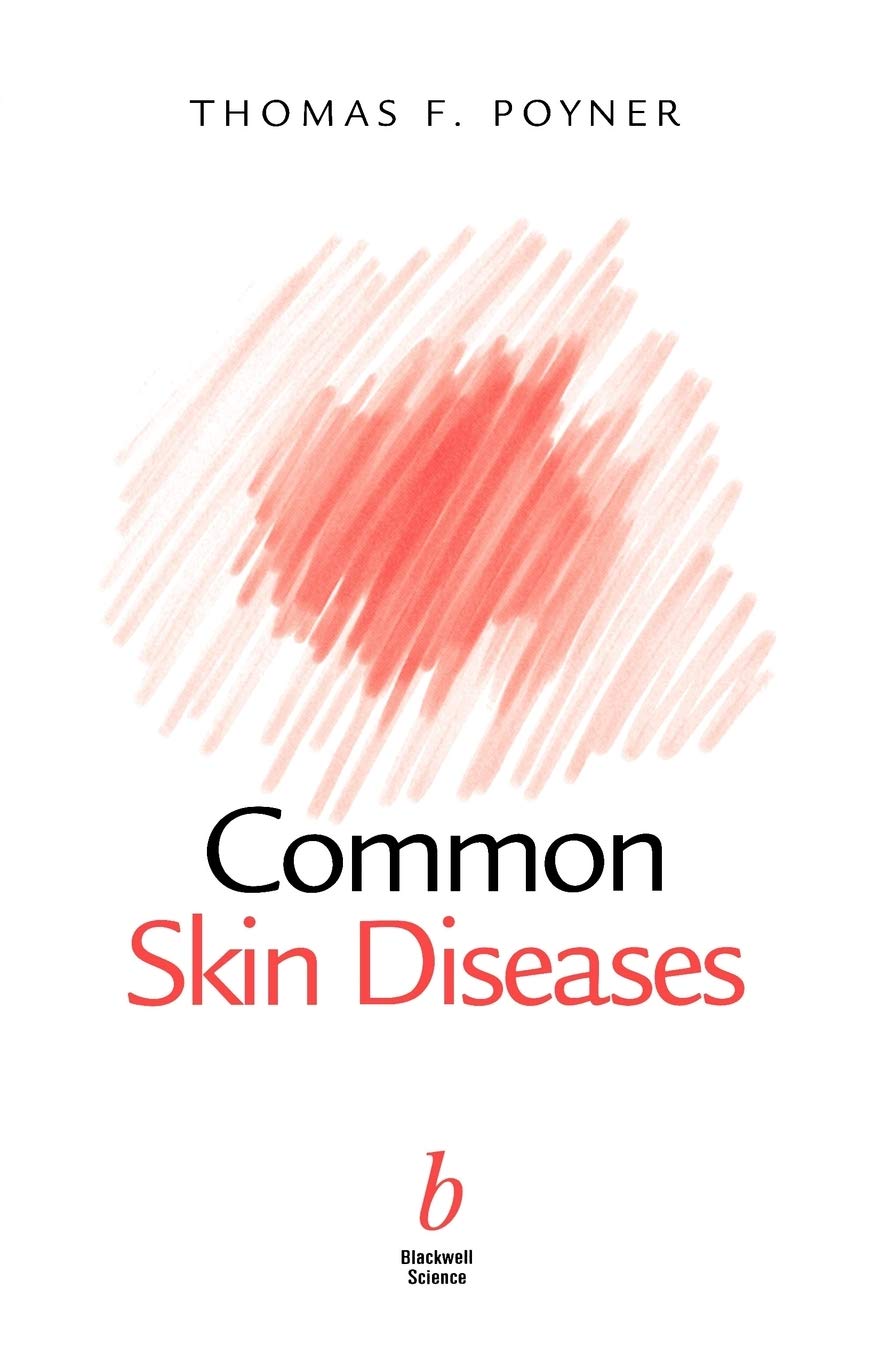 Common Skin Diseases: 1st Edition