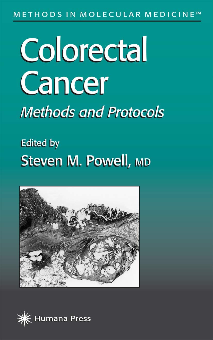 Colorectal Cancer: Methods and Protocols (Methods in Molecular Medicine): Softcover reprint of 1st ed. 2001 Edition