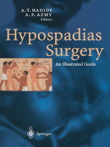 Hypospadias Surgery: An Illustrated Guide