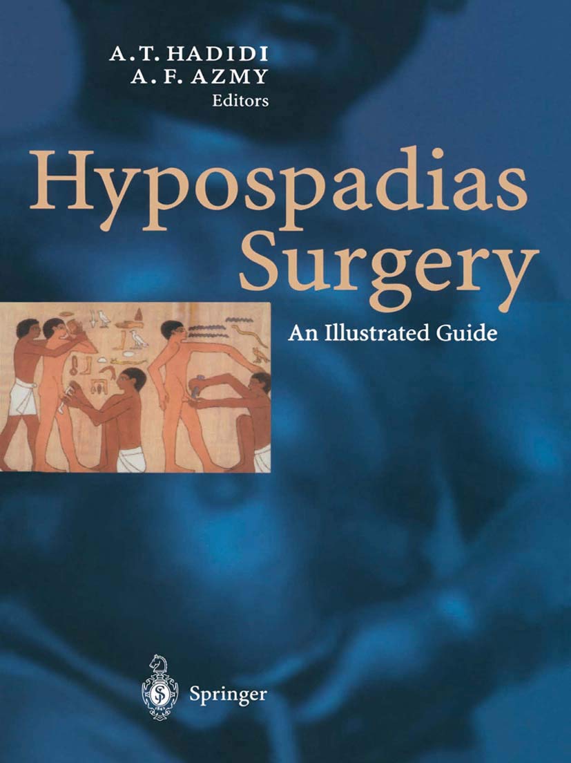 Hypospadias Surgery: An Illustrated Guide
