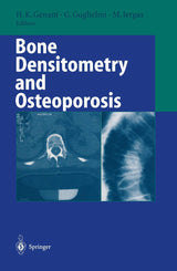 Bone Densitometry and Osteoporosis: 1st Edition