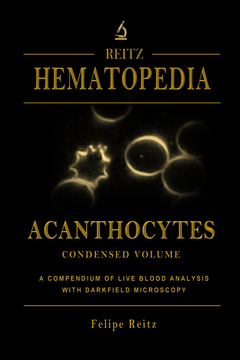 Acanthocytes - Condensed Volume: A Compendium of Live Blood Analysis with Darkfield Microscopy