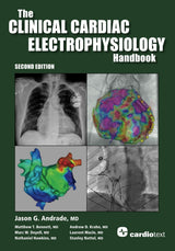 The Clinical Cardiac Electrophysiology Handbook Second Edition