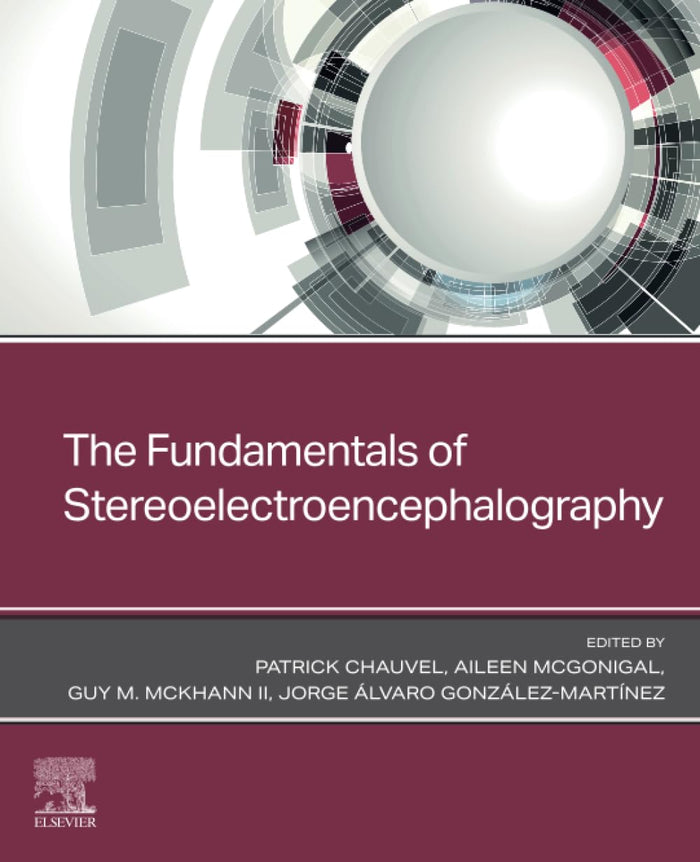 The Fundamentals of Stereoelectroencephalography: 1st Edition