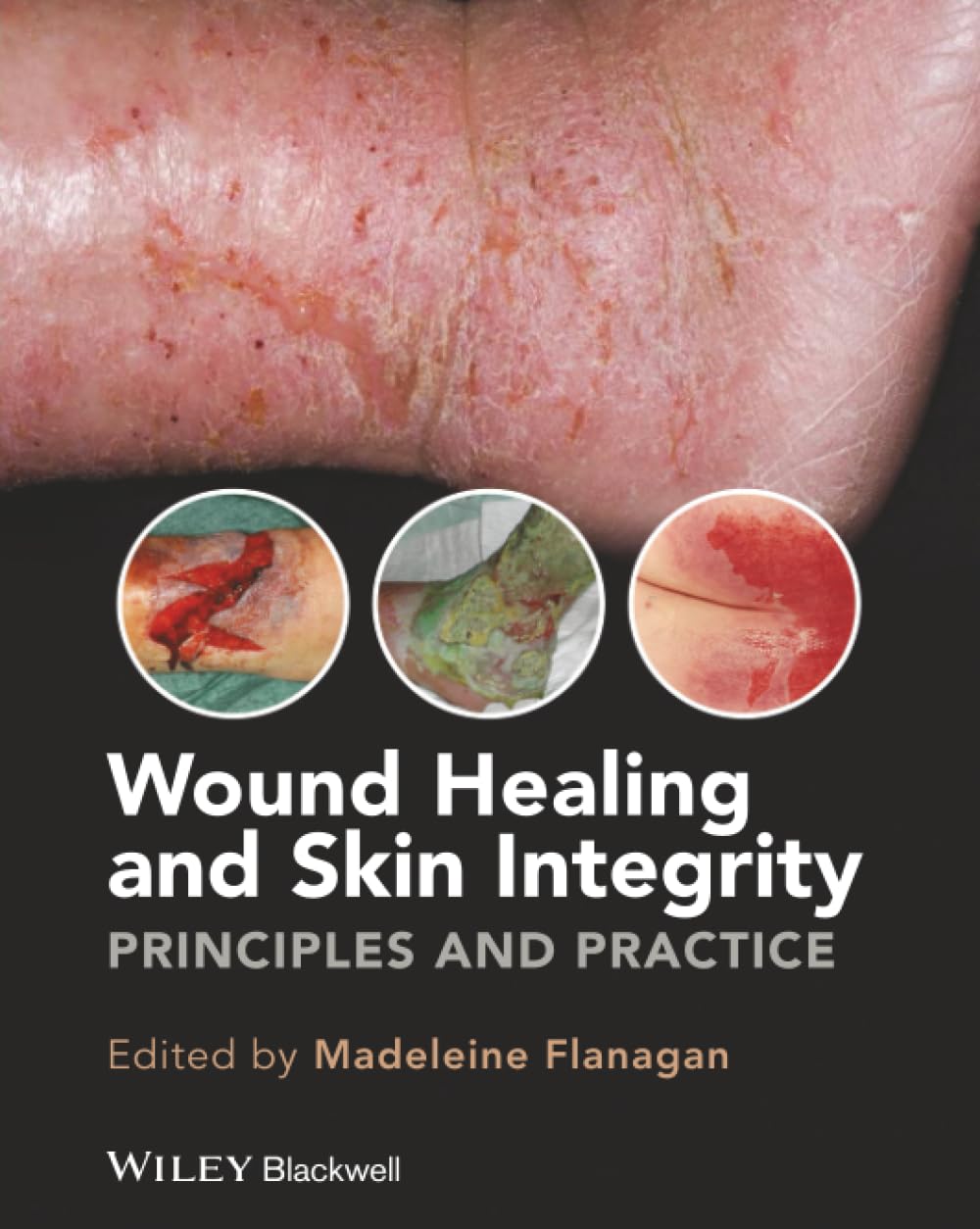 Wound Healing and Skin Integrity: Principles and Practice