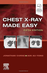 Chest X-Ray Made Easy: 5th Edition