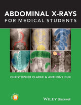 Abdominal X-rays for Medical Students: 1st Edition