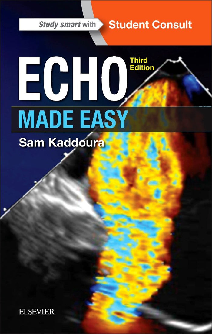 Echo Made Easy: 3rd Edition