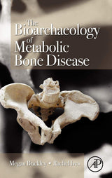 The Bioarchaeology of Metabolic Bone Disease: 1st Edition
