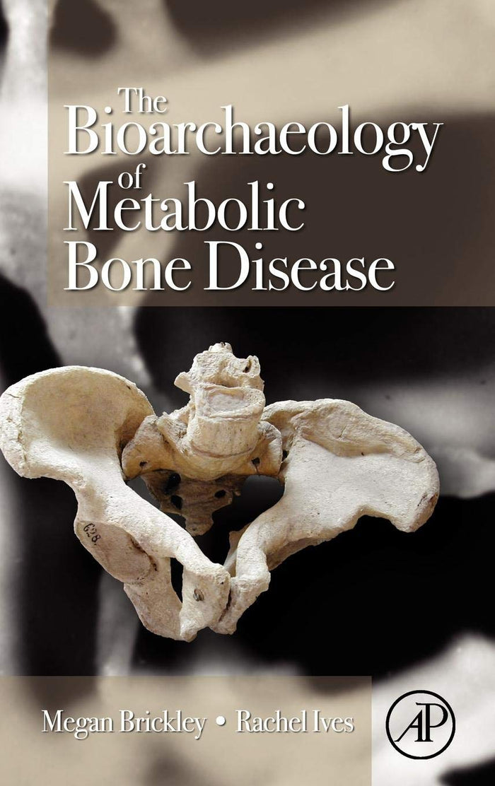The Bioarchaeology of Metabolic Bone Disease: 1st Edition
