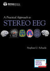 A Practical Approach to Stereo EEG: First Edition