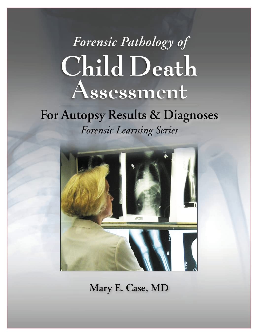 Forensic Pathology of Child Death Assessment (Forensic Learning): 1st Edition
