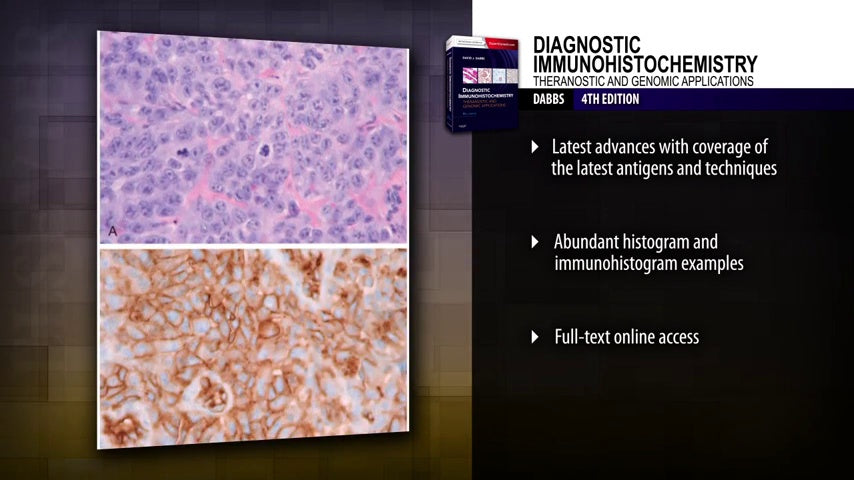 Diagnostic Immunohistochemistry: Theranostic and Genomic Applications, Expert Consult: Online and Print