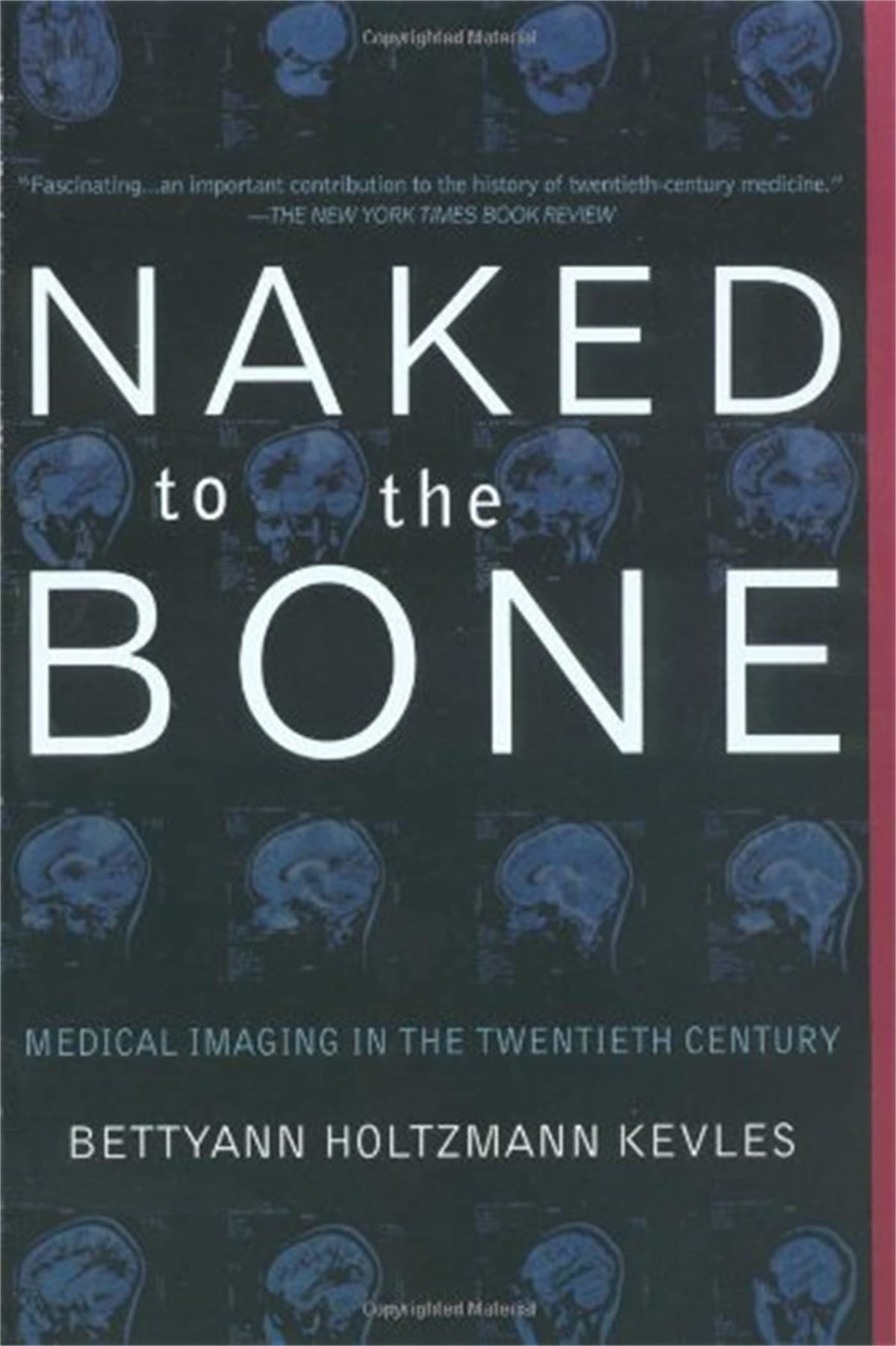 Naked To The Bone: Medical Imaging In The Twentieth Century