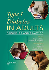 Type 1 Diabetes in Adults: 1st Edition