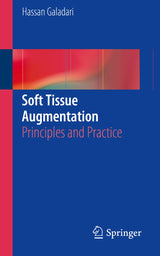 Soft Tissue Augmentation: Principles and Practice