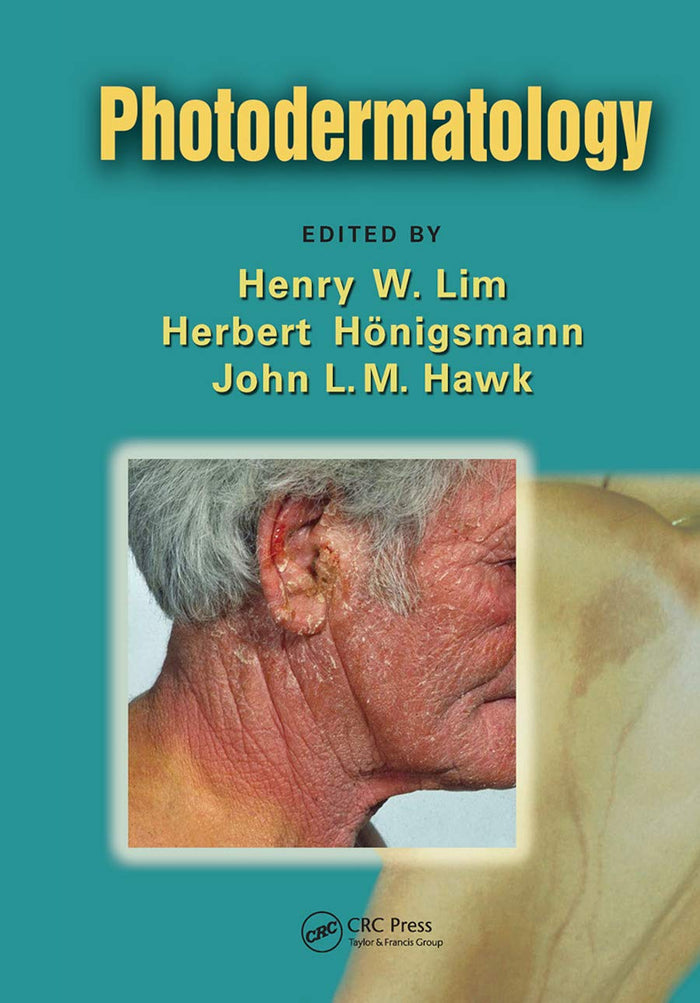 Photodermatology: 1st Edition