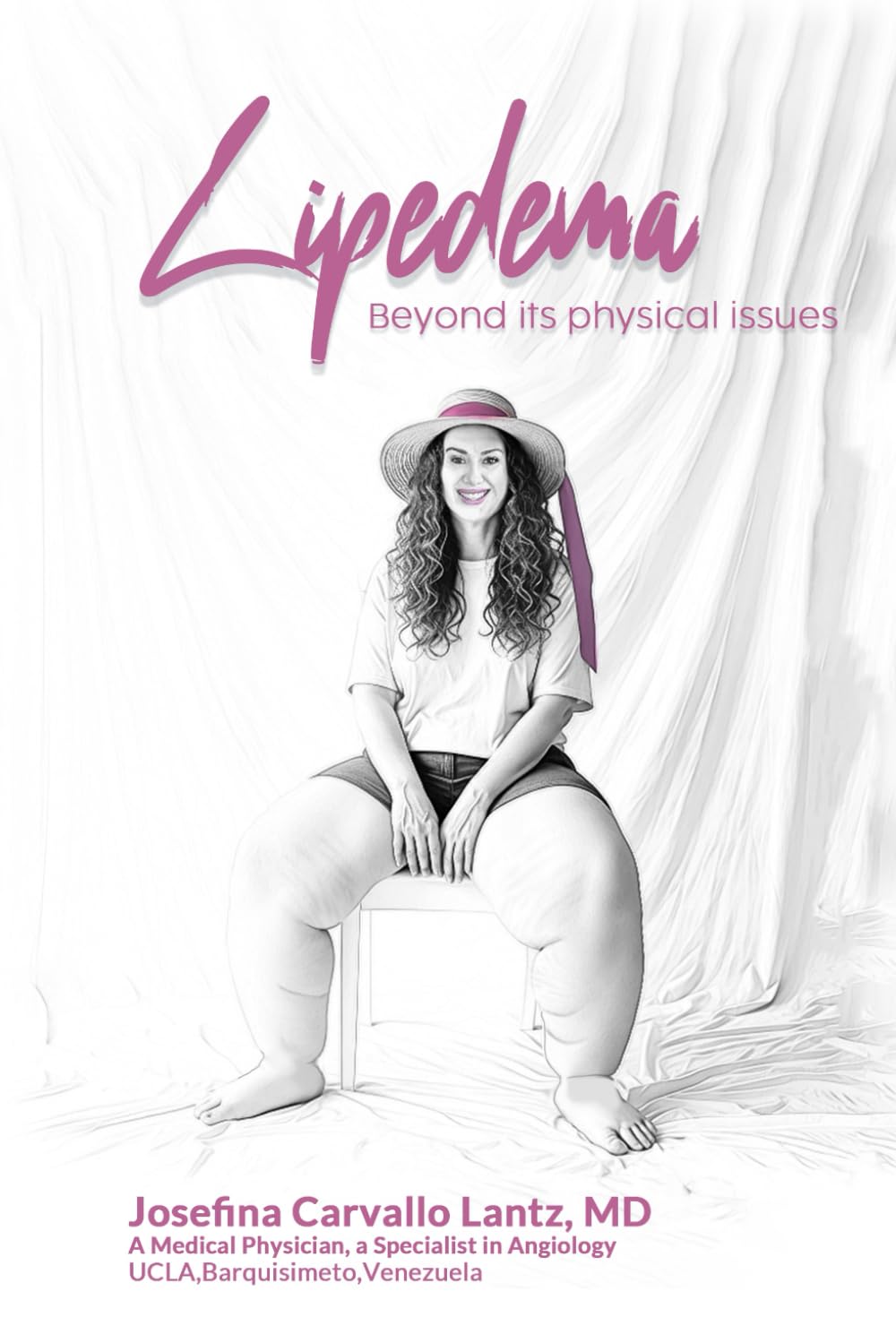 Lipedema: Beyond it's physical issues