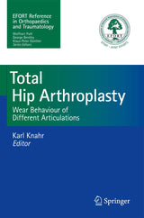 Total Hip Arthroplasty: Wear Behaviour of Different Articulations
