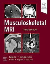 Musculoskeletal MRI: 3rd Edition