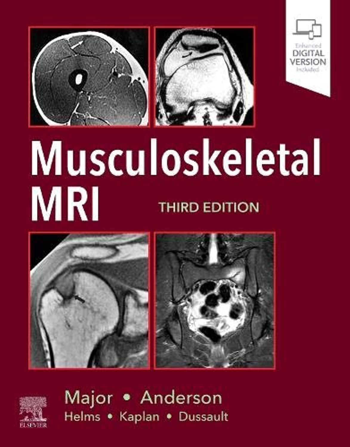 Musculoskeletal MRI: 3rd Edition