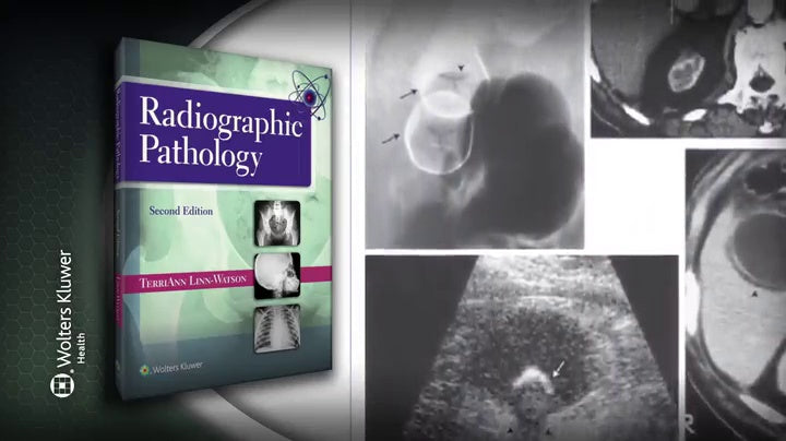 Radiographic Pathology (Point (Lippincott Williams & Wilkins)): Second Edition