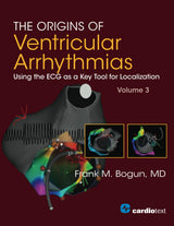 The Origins of Ventricular Arrhythmias: Using the ECG as a Key Tool for Localization