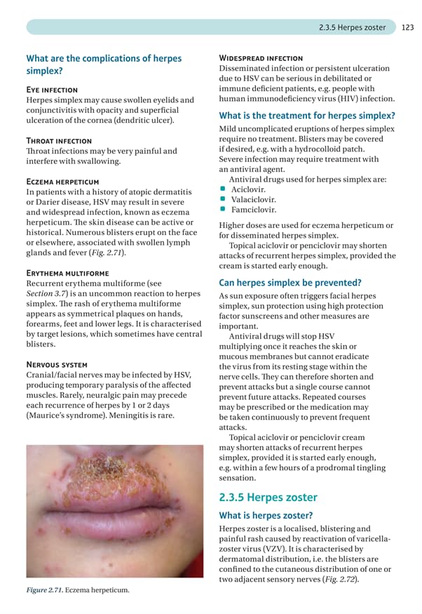 Dermatology Made Easy, second edition