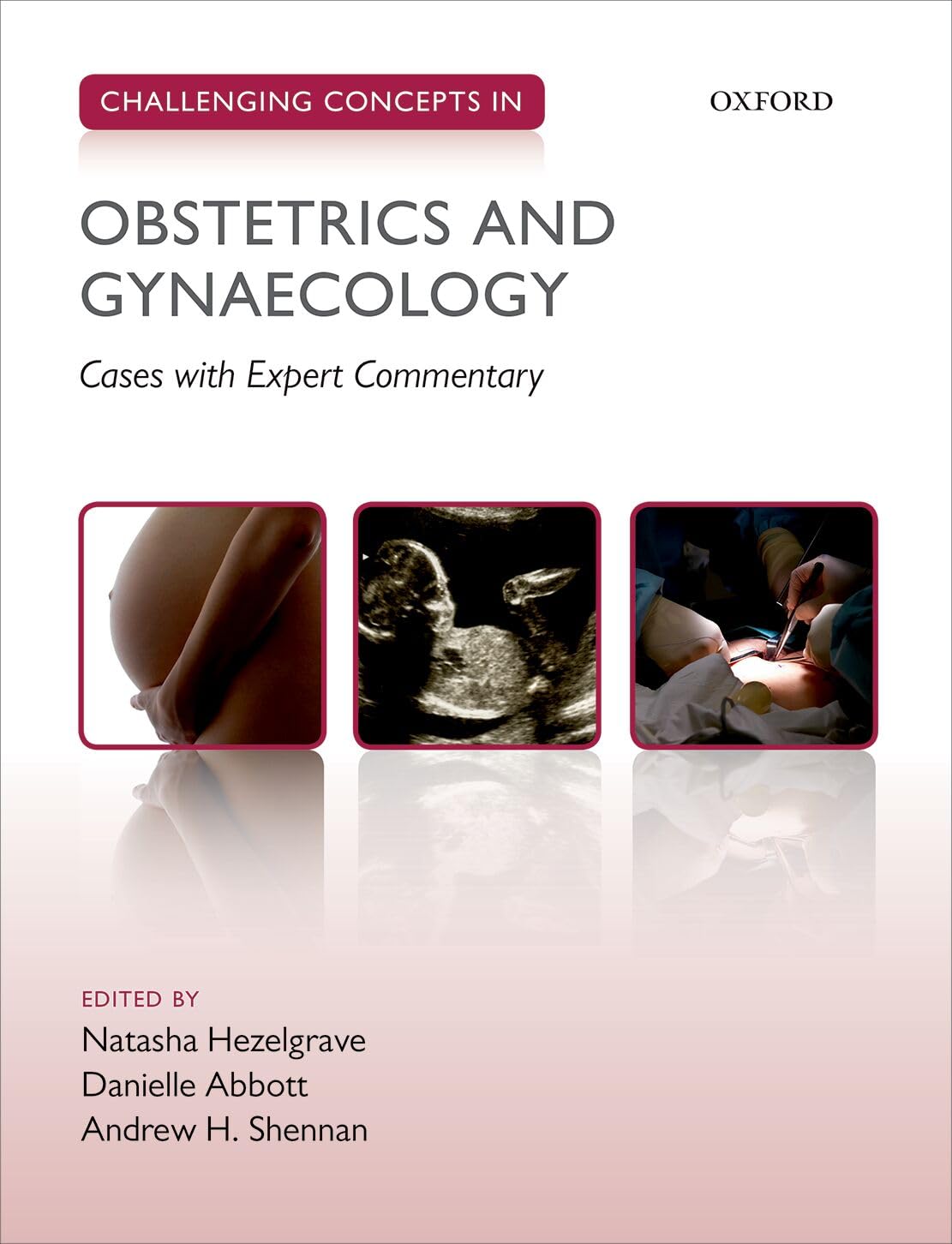 Obstetrics and Gynaecology (Challenging Concepts) (Challenging Cases): 1st Edition