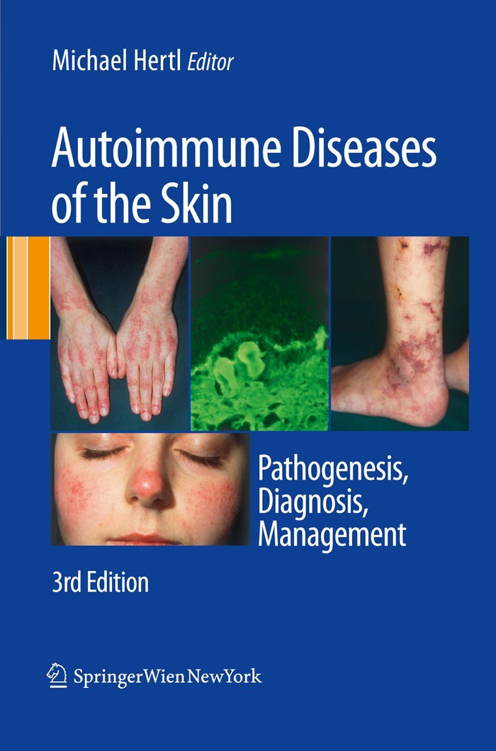 Autoimmune Diseases of the Skin: Pathogenesis, Diagnosis, Management: Third Edition 2011