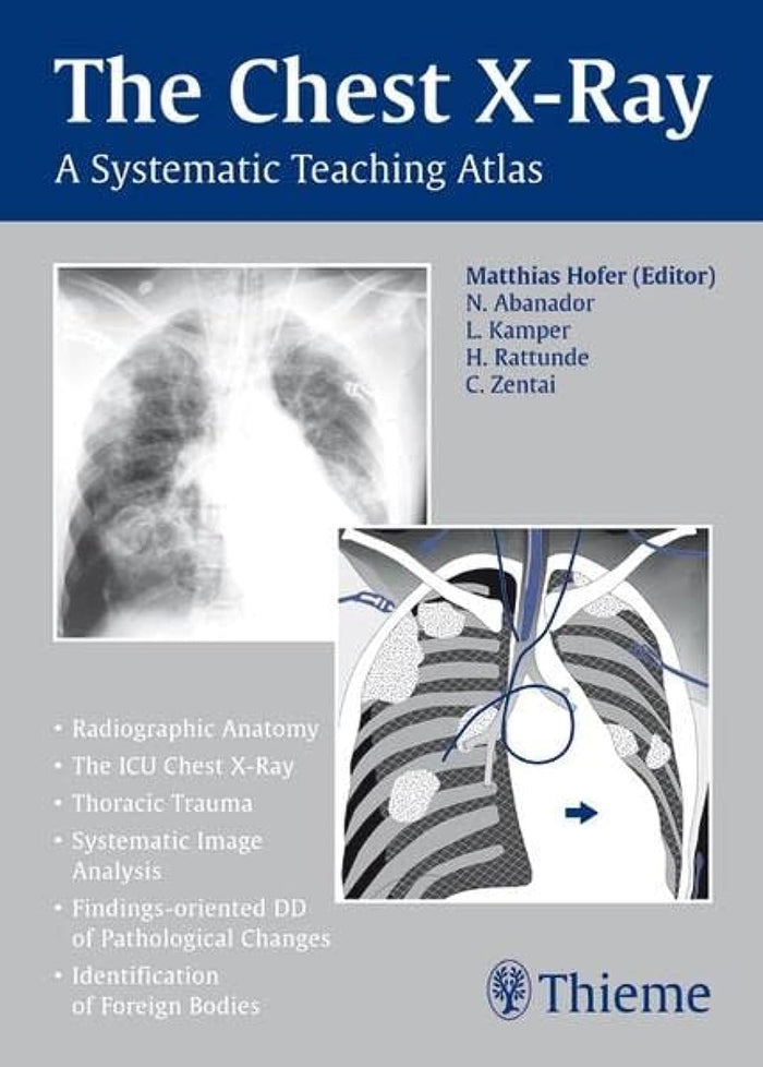 The Chest X-Ray: A Systematic Teaching Atlas