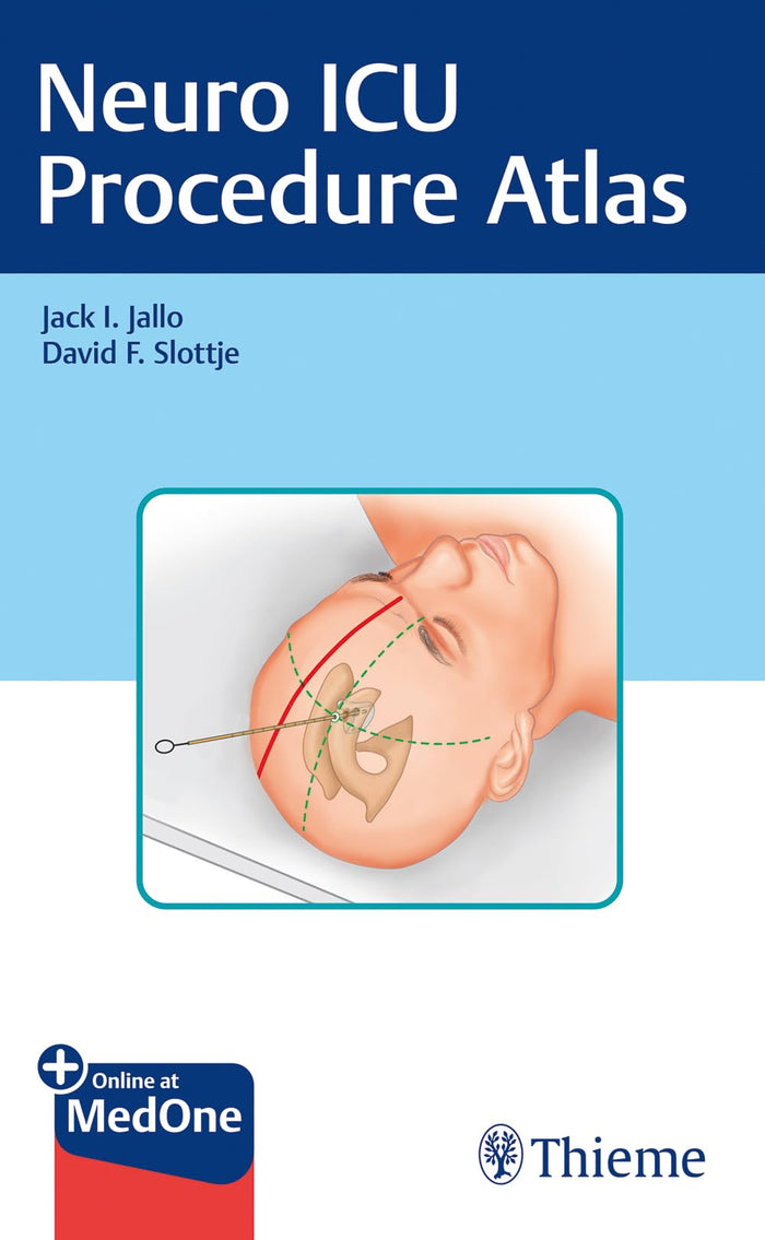 Neuro ICU Procedure Atlas: 1st Edition