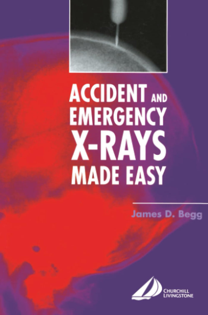 Accident and Emergency X-Rays Made Easy: 1st Edition