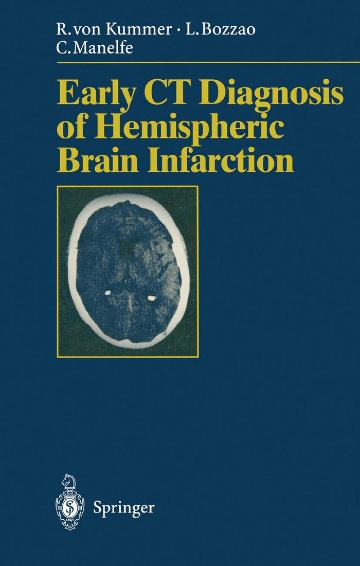 Early CT Diagnosis of Hemispheric Brain Infarction: 1st Edition