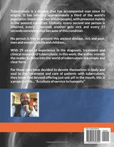 TUBERCULOSIS: VOLUME I (TUBERCULOSIS 2024. THIRD ENGLISH EDITION)