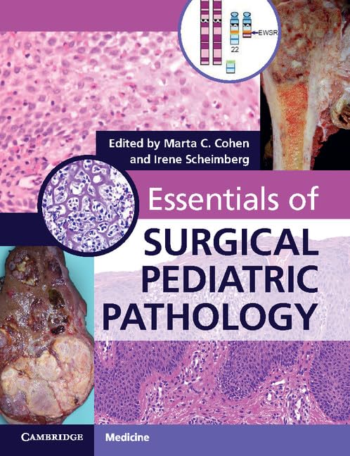 Essentials of Surgical Pediatric Pathology with DVD-ROM: 1st Edition