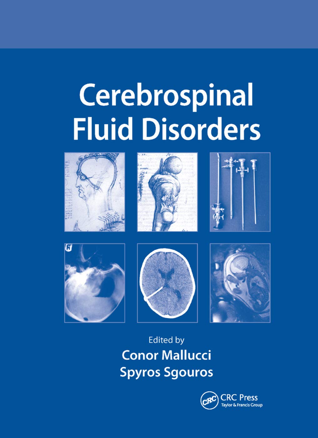 Cerebrospinal Fluid Disorders: 1st Edition