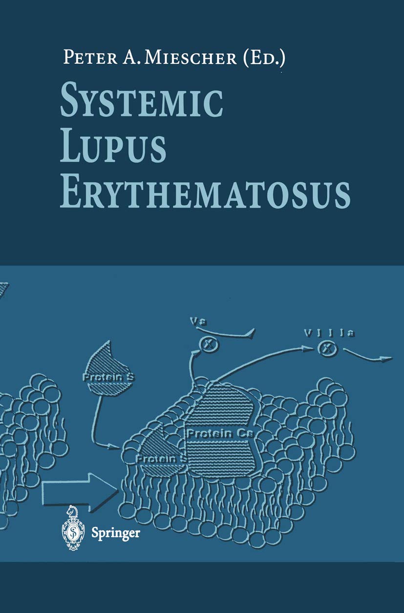 Systemic Lupus Erythematosus: 1st Edition