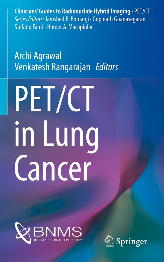 PET/CT in Lung Cancer (Clinicians’ Guides to Radionuclide Hybrid Imaging)