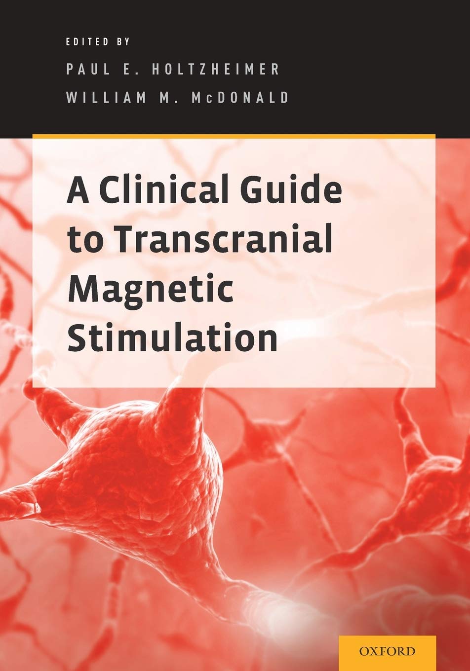 A Clinical Guide to Transcranial Magnetic Stimulation: 1st Edition