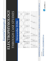 Essential Concepts of Electrophysiology Through Case Studies: Intracardiac EGMs