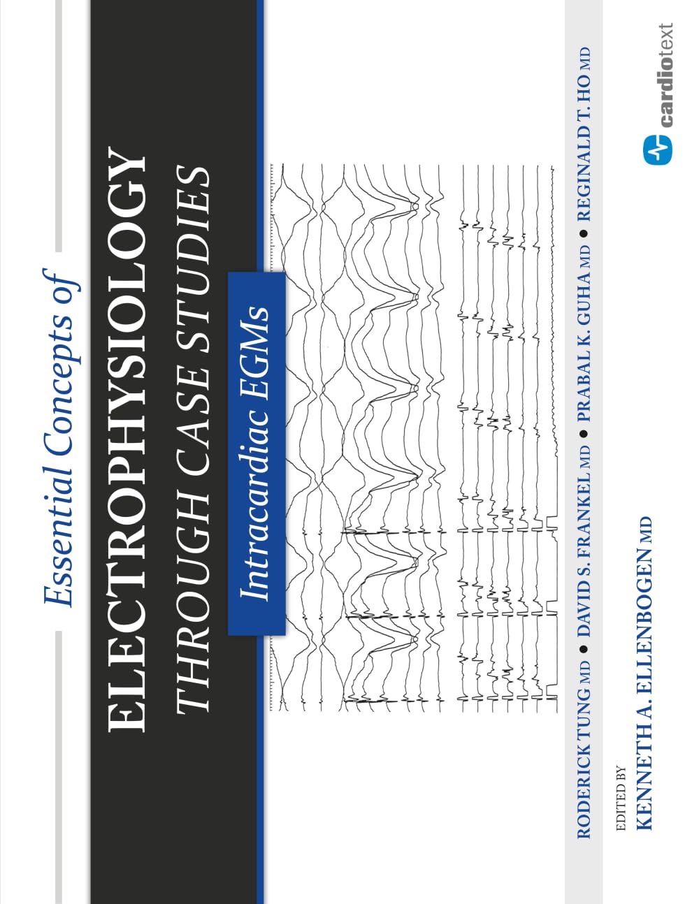 Essential Concepts of Electrophysiology Through Case Studies: Intracardiac EGMs